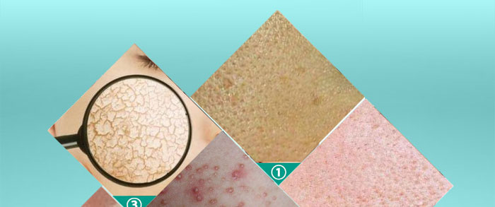 ��ˬƽ��PH�{��¶