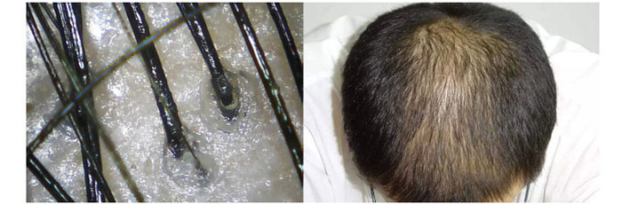 ���ϼ���-�Ř�ɽ����ϴ�l��