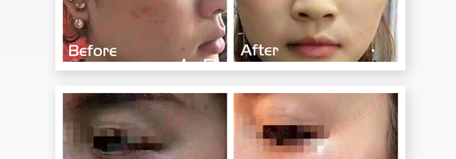 ΢�ķ����oԭҺ