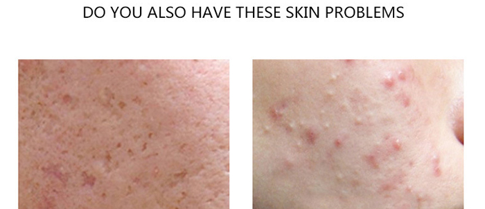 ���B���������o��