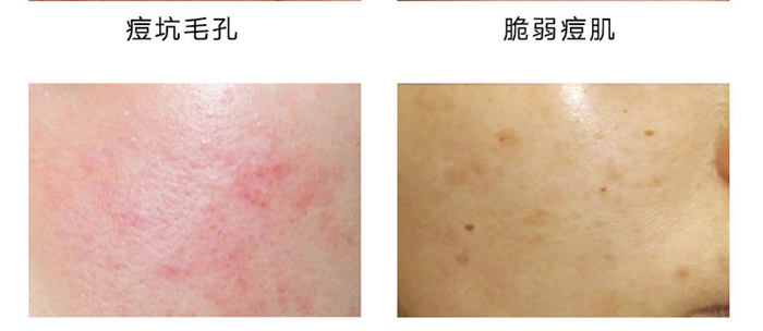 ���B���������o��