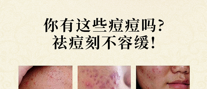 �琂�òݱ�ֲ����M��