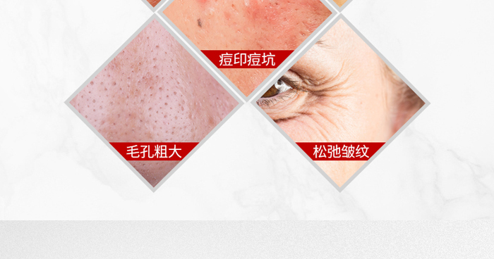 ������Ҽ������o���ɷ�+�������o��ýҺ